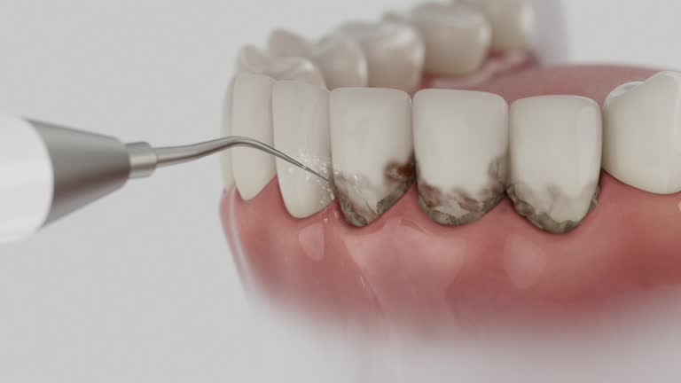 Reliable Dental Implants contractor in Sturgis, MI by Smile Center Dentistry